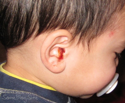 picture of a bloody ear