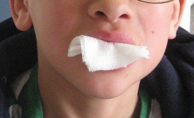 picture of a child biting gauze