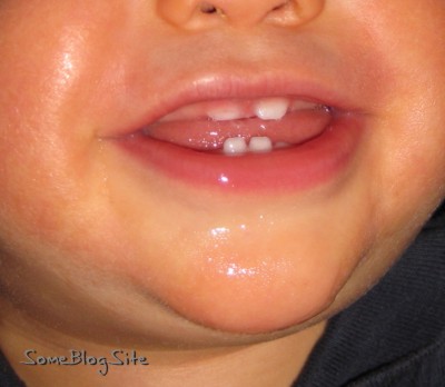 picture of baby's first four teeth