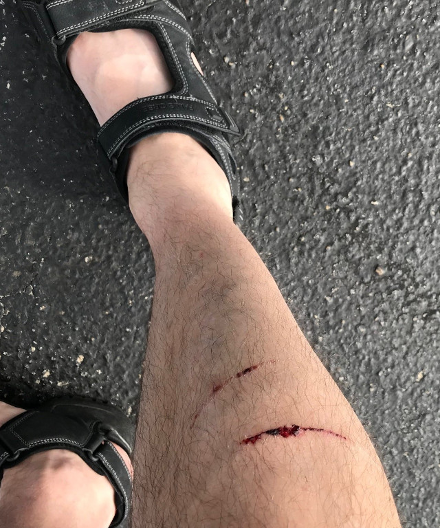 image of a leg with cuts on it